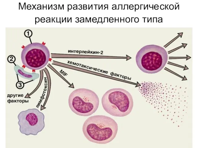 Механизм развития аллергической реакции замедленного типа