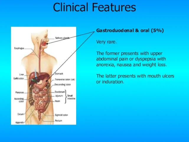 Gastroduodenal & oral (5%) Very rare. The former presents with upper abdominal
