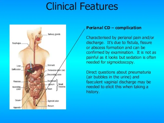 Perianal CD – complication Characterised by perianal pain and/or discharge. It’s due