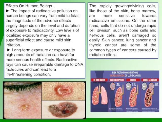 Effects On Human Beings . ► The impact of radioactive pollution on