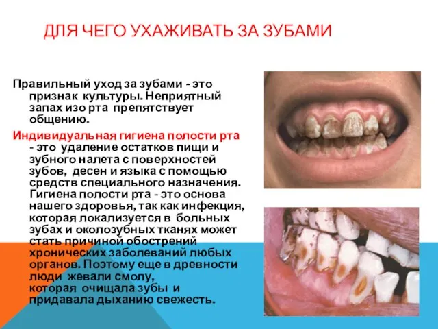 ДЛЯ ЧЕГО УХАЖИВАТЬ ЗА ЗУБАМИ Правильный уход за зубами - это признак