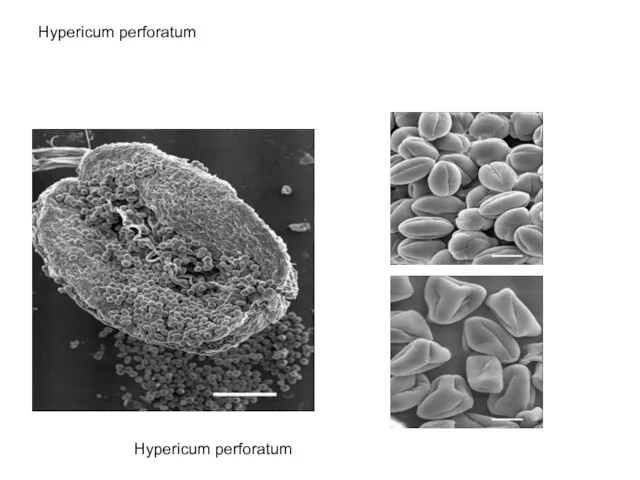 Hypericum perforatum Hypericum perforatum