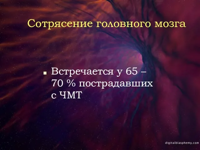 Сотрясение головного мозга Встречается у 65 – 70 % пострадавших с ЧМТ