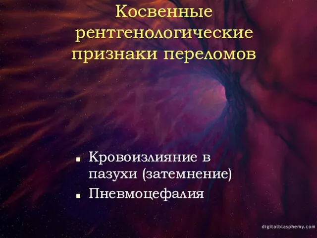 Косвенные рентгенологические признаки переломов Кровоизлияние в пазухи (затемнение) Пневмоцефалия