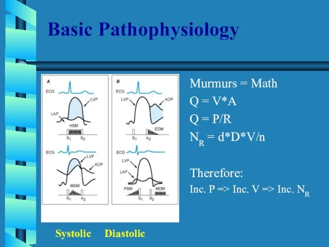 Basic Pathophysiology Murmurs = Math Q = V*A Q = P/R NR