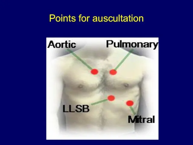 Points for auscultation