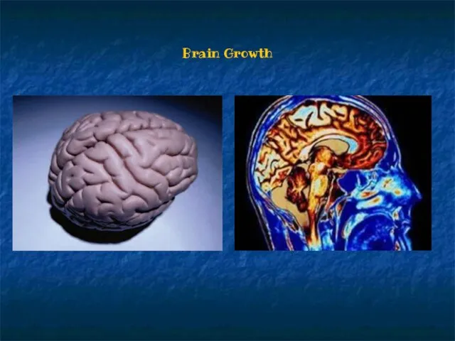 Brain Growth