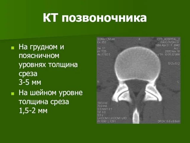 КТ позвоночника На грудном и поясничном уровнях толщина среза 3-5 мм На