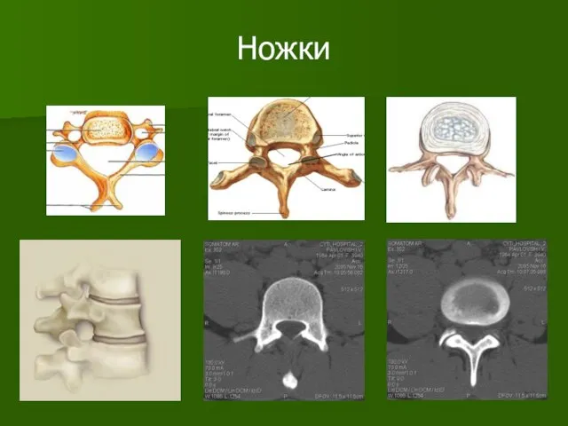 Ножки