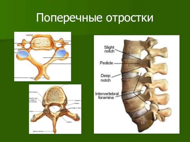 Поперечные отростки