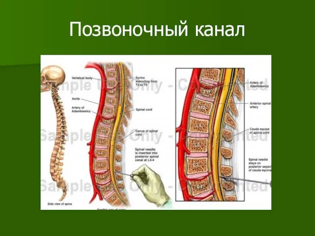 Позвоночный канал