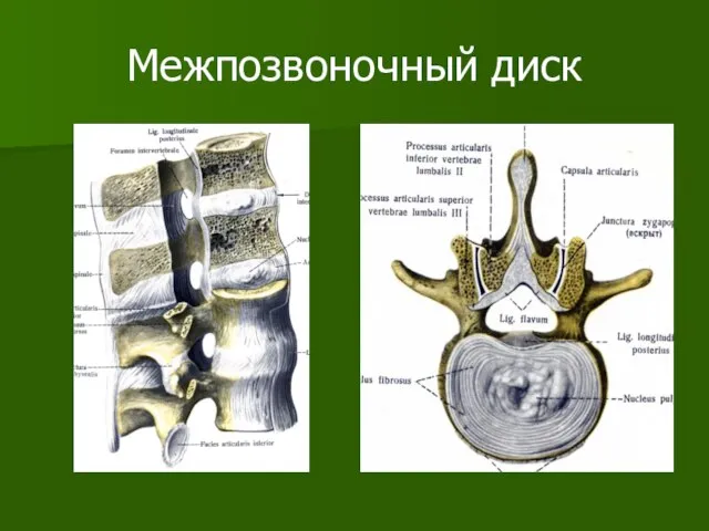 Межпозвоночный диск