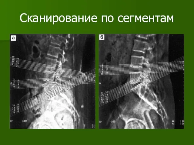 Сканирование по сегментам