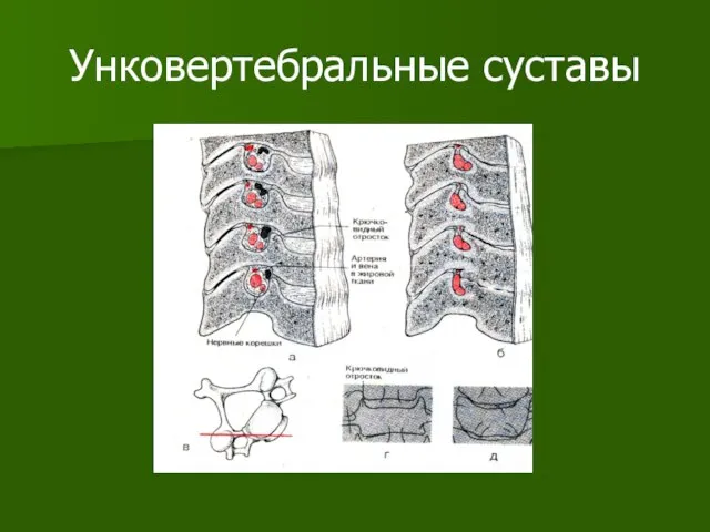 Унковертебральные суставы