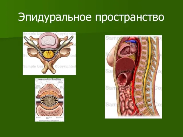 Эпидуральное пространство