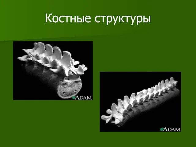 Костные структуры