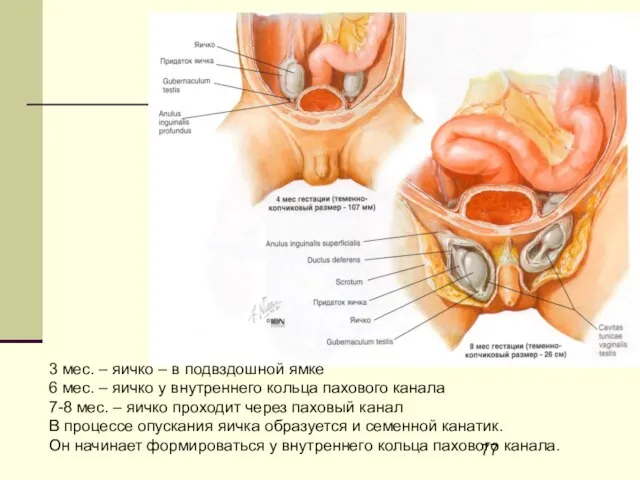 3 мес. – яичко – в подвздошной ямке 6 мес. – яичко