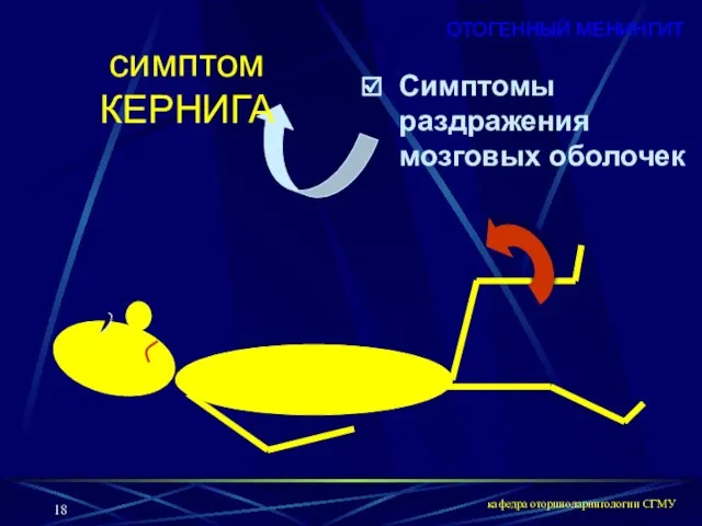 кафедра оториноларингологии СГМУ Симптомы раздражения мозговых оболочек симптом КЕРНИГА ОТОГЕННЫЙ МЕНИНГИТ