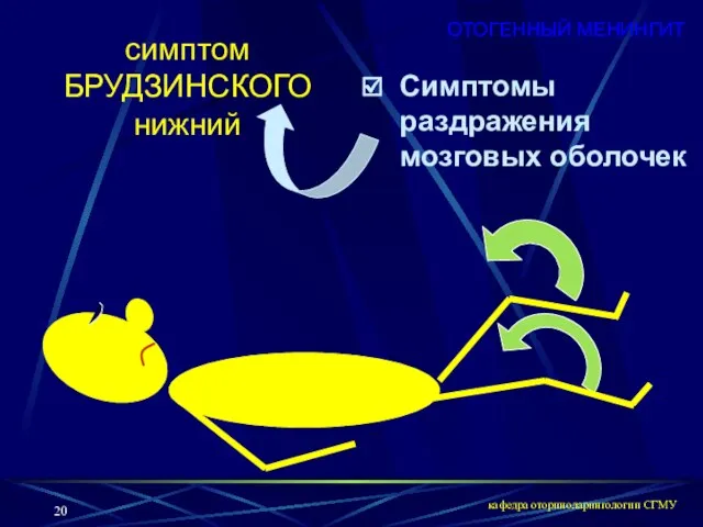 кафедра оториноларингологии СГМУ Симптомы раздражения мозговых оболочек симптом БРУДЗИНСКОГО нижний ОТОГЕННЫЙ МЕНИНГИТ