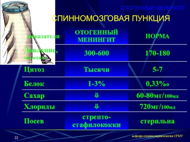 кафедра оториноларингологии СГМУ СПИННОМОЗГОВАЯ ПУНКЦИЯ ОТОГЕННЫЙ МЕНИНГИТ