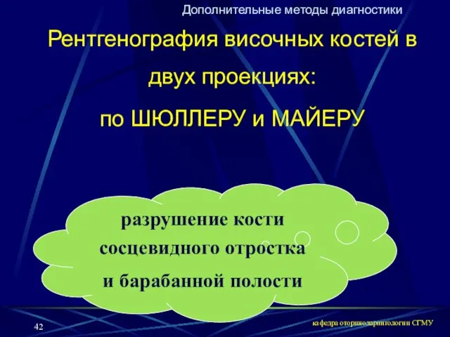 кафедра оториноларингологии СГМУ Дополнительные методы диагностики Рентгенография височных костей в двух проекциях: