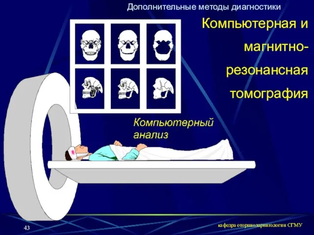 кафедра оториноларингологии СГМУ Дополнительные методы диагностики Компьютерная и магнитно-резонансная томография