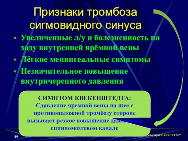 кафедра оториноларингологии СГМУ Признаки тромбоза сигмовидного синуса Увеличенные л/у и болезненность по