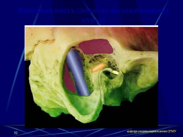 кафедра оториноларингологии СГМУ Височная кость (пособие по секционному курсу)