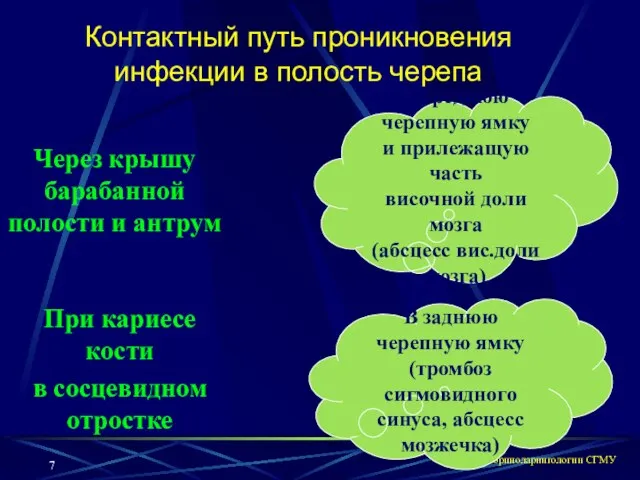 кафедра оториноларингологии СГМУ Контактный путь проникновения инфекции в полость черепа Через крышу