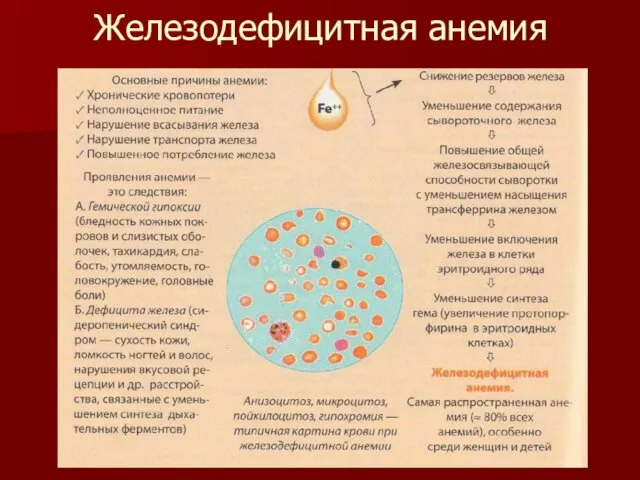 Железодефицитная анемия