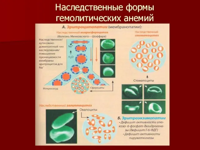 Наследственные формы гемолитических анемий