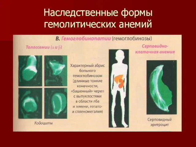 Наследственные формы гемолитических анемий