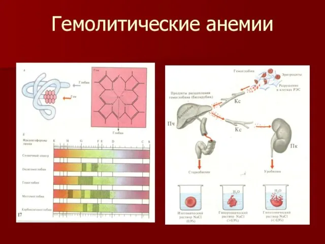 Гемолитические анемии