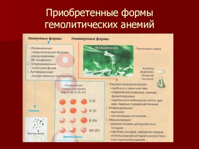 Приобретенные формы гемолитических анемий