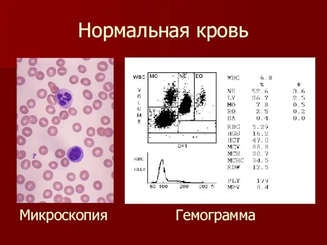 Нормальная кровь Микроскопия Гемограмма