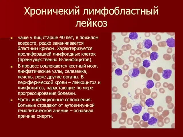 Хроничекий лимфобластный лейкоз чаще у лиц старше 40 лет, в пожилом возрасте,