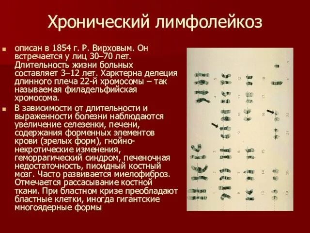 Хронический лимфолейкоз описан в 1854 г. Р. Вирховым. Он встречается у лиц
