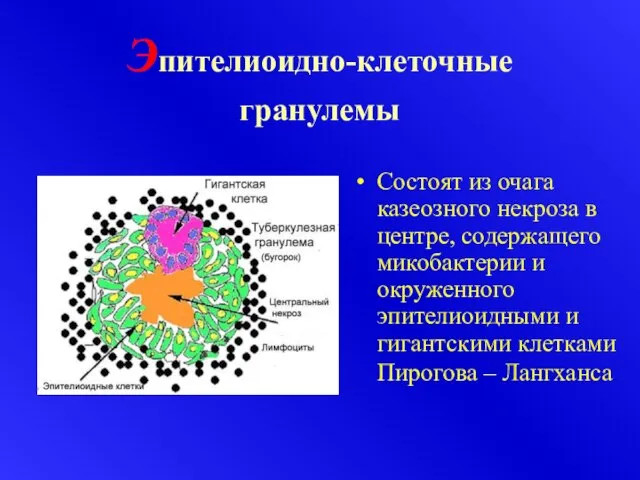 Эпителиоидно-клеточные гранулемы Состоят из очага казеозного некроза в центре, содержащего микобактерии и