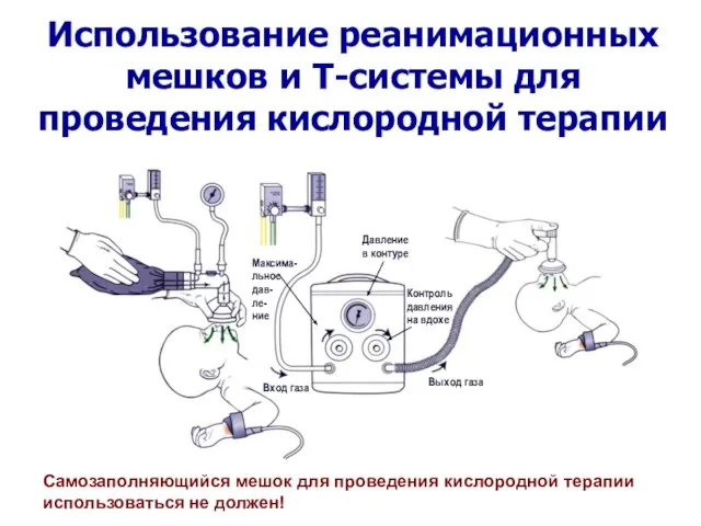 Использование реанимационных мешков и Т-системы для проведения кислородной терапии Самозаполняющийся мешок для