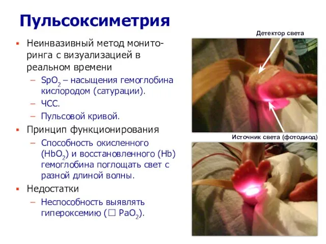 Пульсоксиметрия Неинвазивный метод монито-ринга с визуализацией в реальном времени SpO2 – насыщения