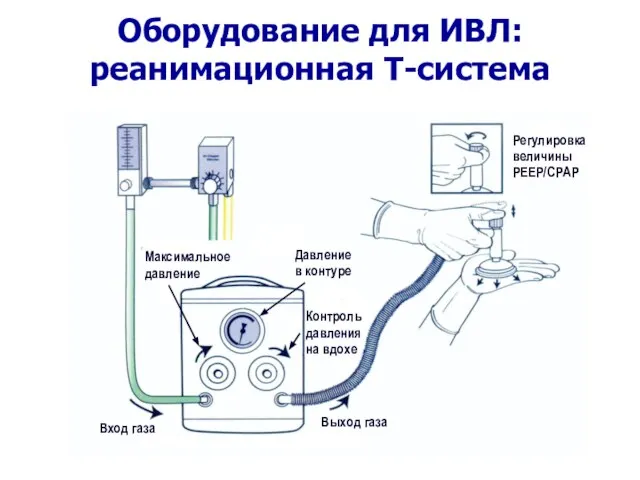 Оборудование для ИВЛ: реанимационная Т-система Выход газа Вход газа Давление в контуре