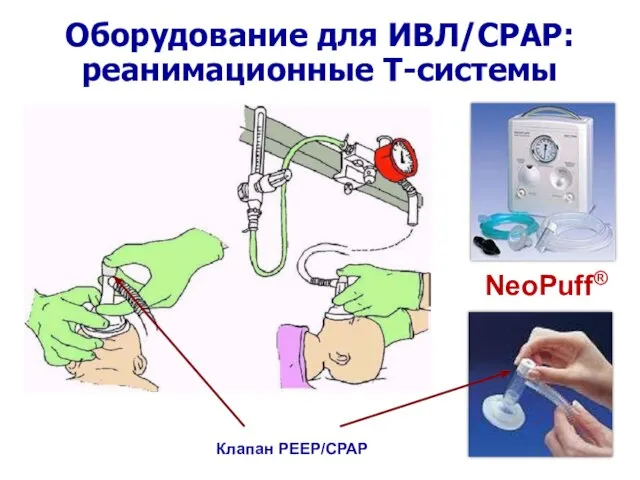 Оборудование для ИВЛ/СРАР: реанимационные Т-системы NeoPuff® Клапан РЕЕР/СРАР