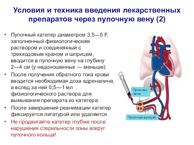 Условия и техника введения лекарственных препаратов через пупочную вену (2) Пупочный катетер