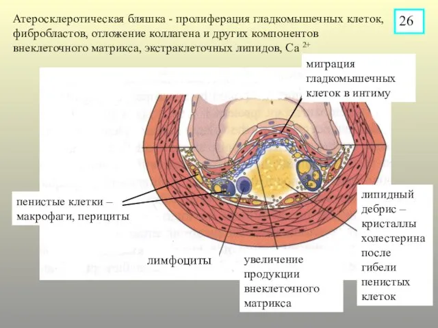 Атеросклеротическая бляшка - пролиферация гладкомышечных клеток, фибробластов, отложение коллагена и других компонентов