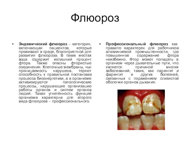 Флюороз Эндемический флюороз – категория, включающая пациентов, которые проживают в среде, благоприятной