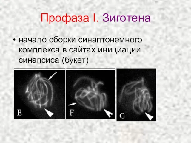 Профаза I. Зиготена начало сборки синаптонемного комплекса в сайтах инициации синапсиса (букет)