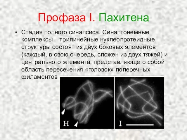 Профаза I. Пахитена Стадия полного синапсиса. Синаптонемные комплексы – трилинейные нуклеопротеидные структуры