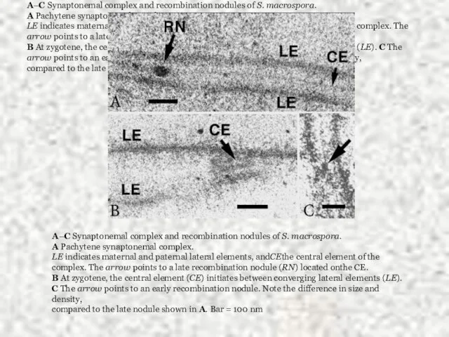 A–C Synaptonemal complex and recombination nodules of S. macrospora. A Pachytene synaptonemal