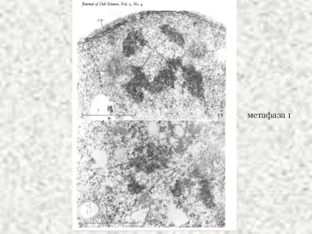метафаза 1
