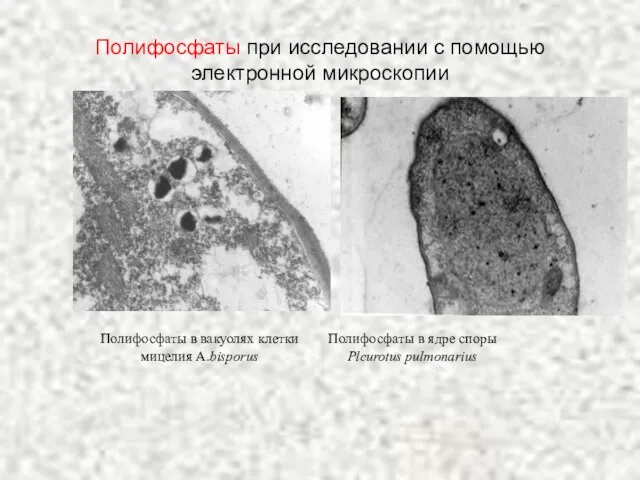 Полифосфаты при исследовании с помощью электронной микроскопии